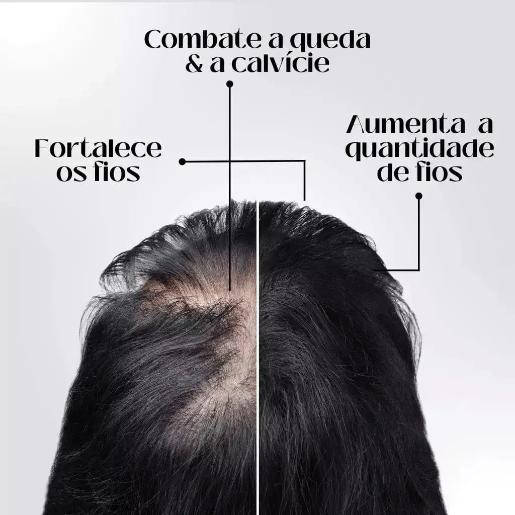Repair Hair Regrowth - Óleo de Crescimento Capilar