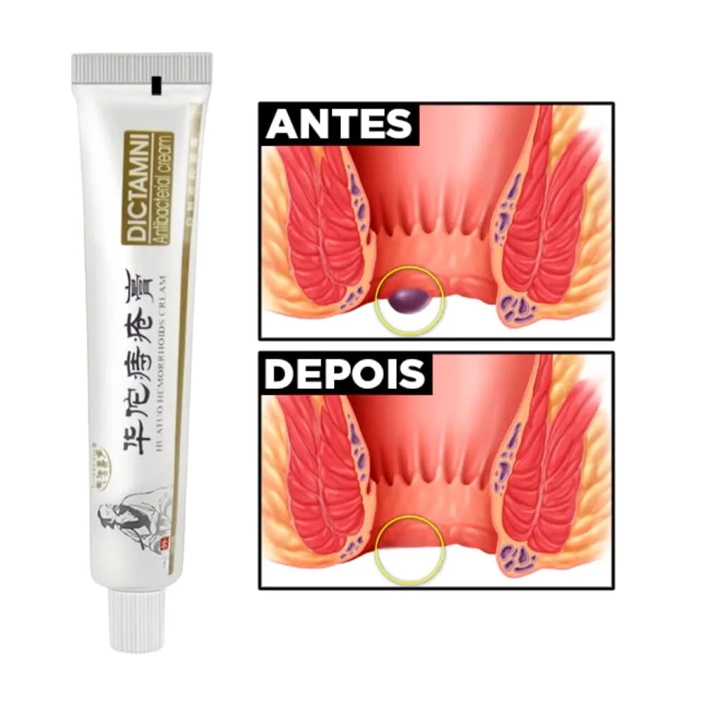 Pomada Dictamni Hemorroida, Fissura, Coceira, Alivio Imediato