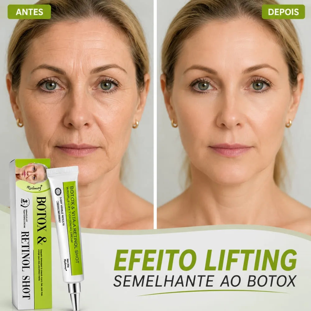 celimax
celinax
retinol shot
retinol creamy
linhas finas
creamy retinol