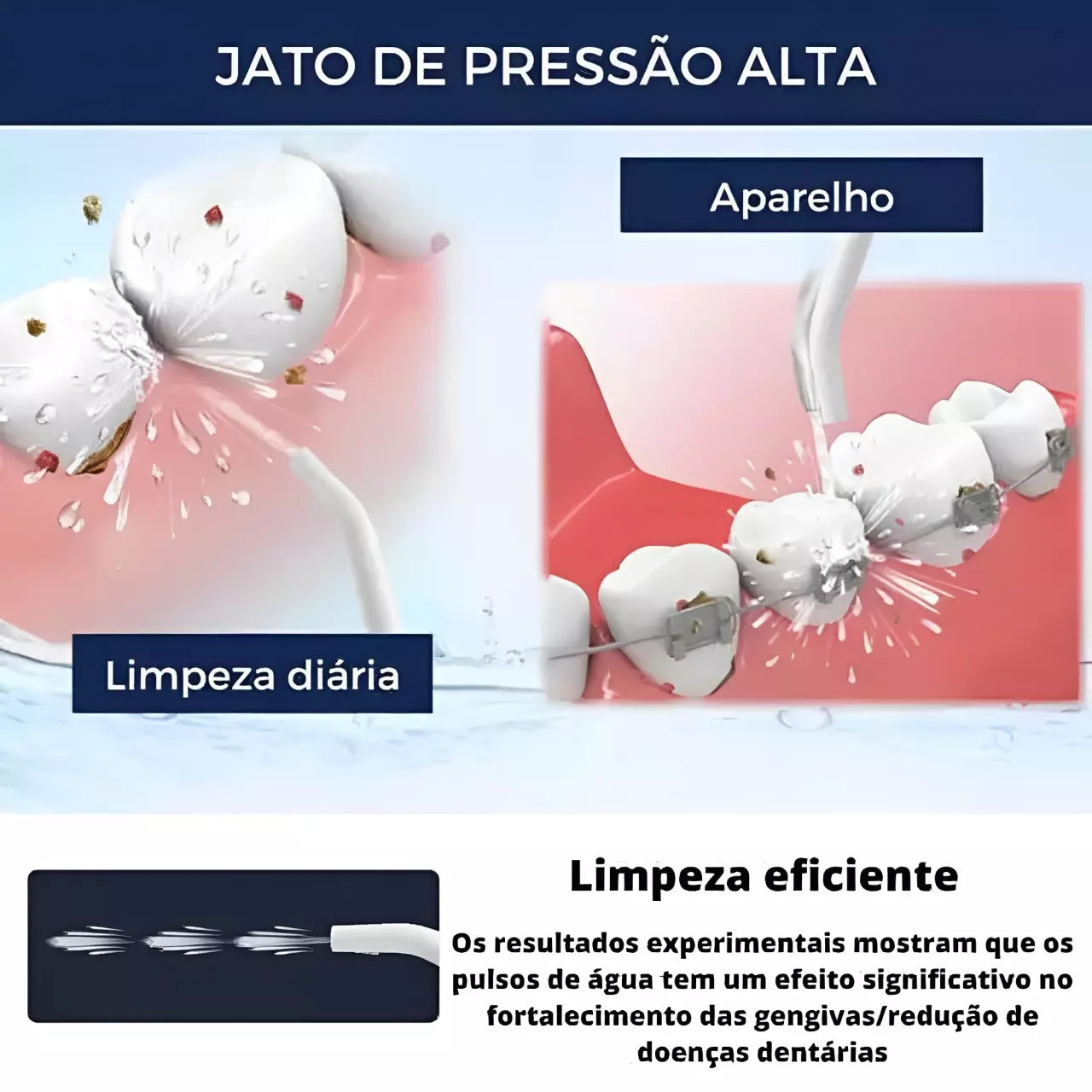 Irrigador Dental - Eficiente e Prático